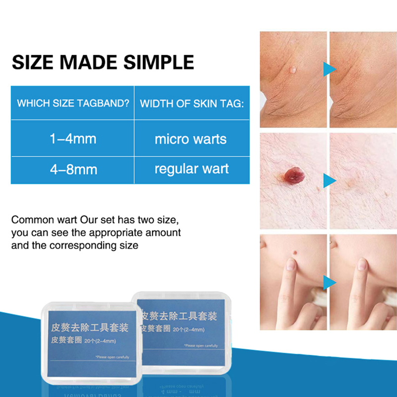 20 Stück/Box Flesh Nevus Entfe – Electro Gadgets Bewertung und Preis